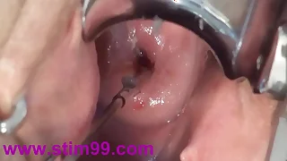 79 extreme porn videos